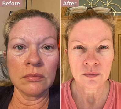 Linda's story