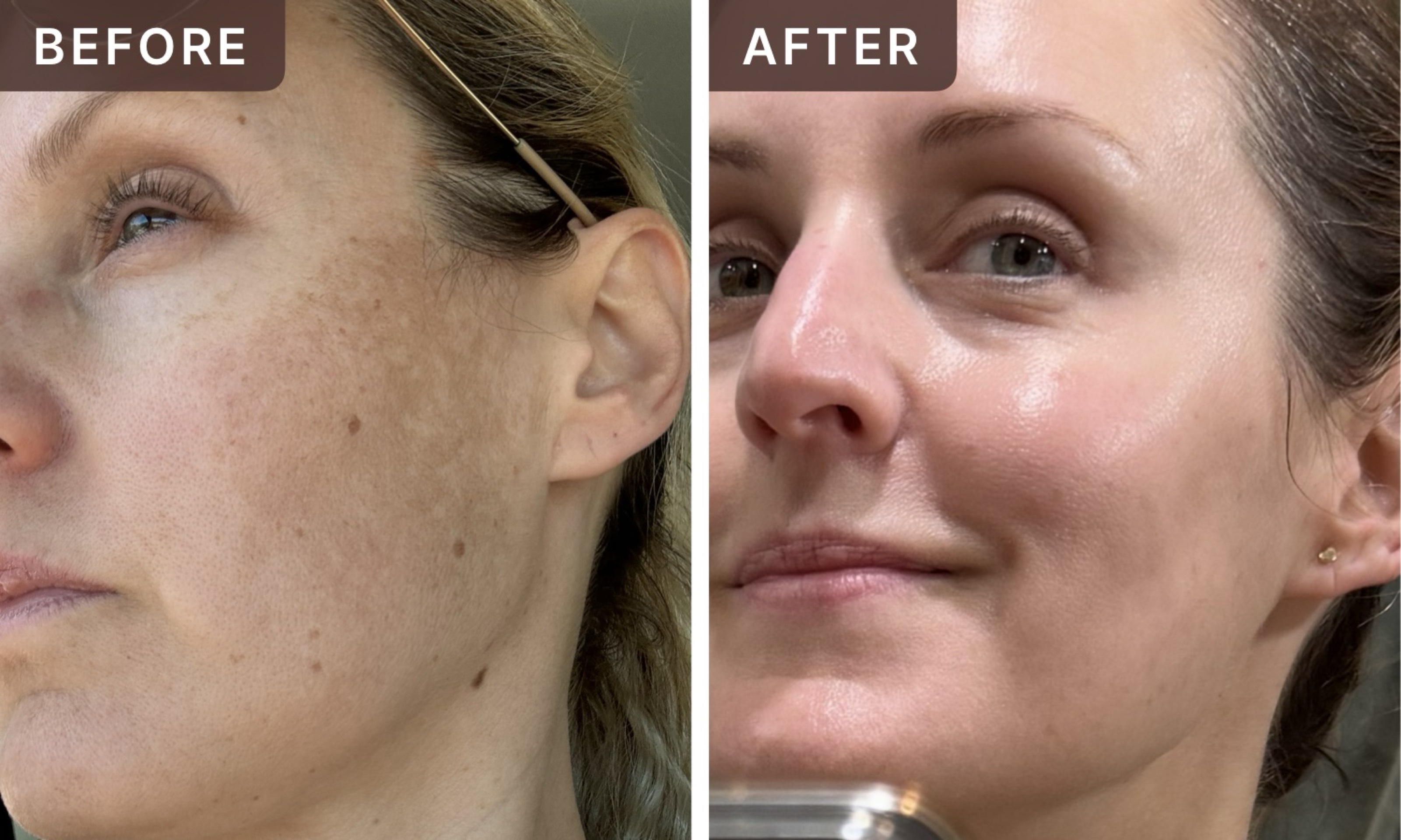 Bri B. -- before and after, 8 weeks