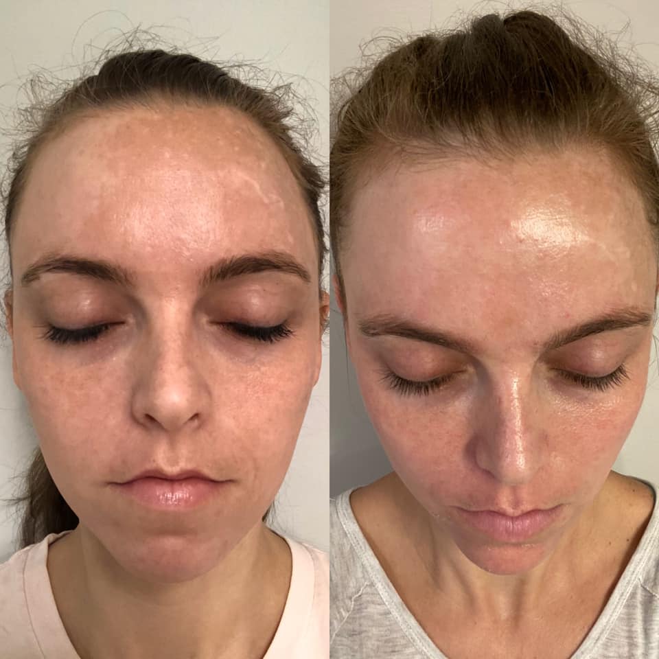 Customer photo