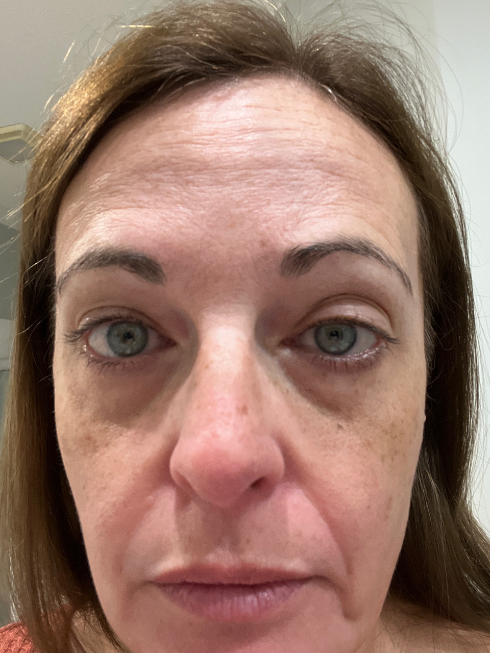 The Eye Serum review photo by Kelly H.