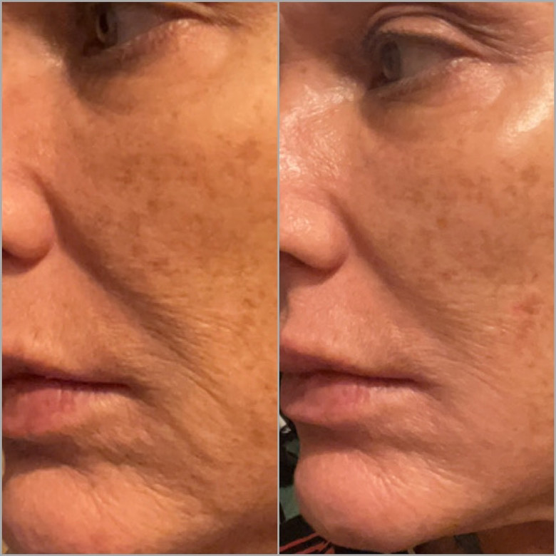 The Anti-Aging Cream review photo by Susan M.