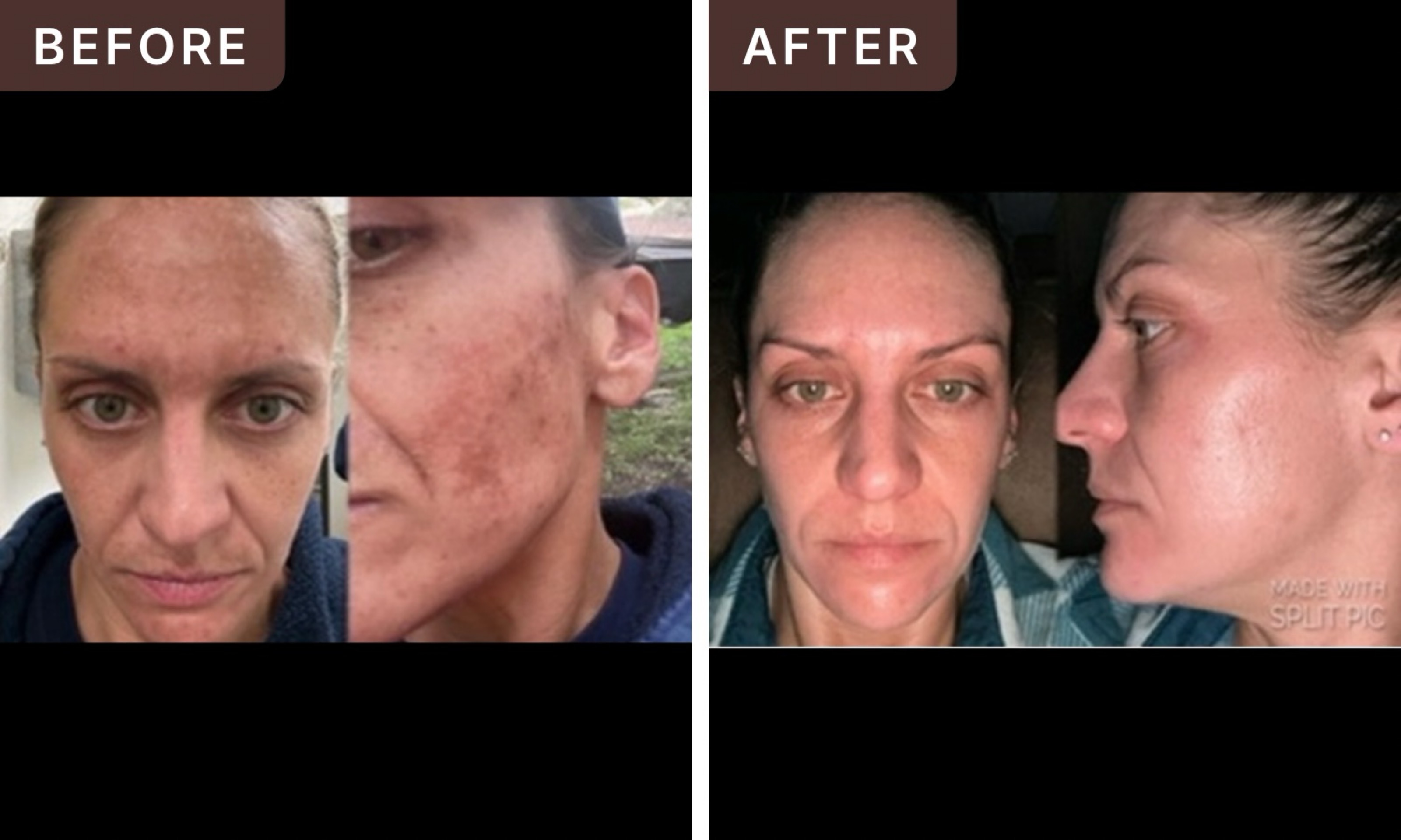 Kristen E. -- before and after, 8 weeks