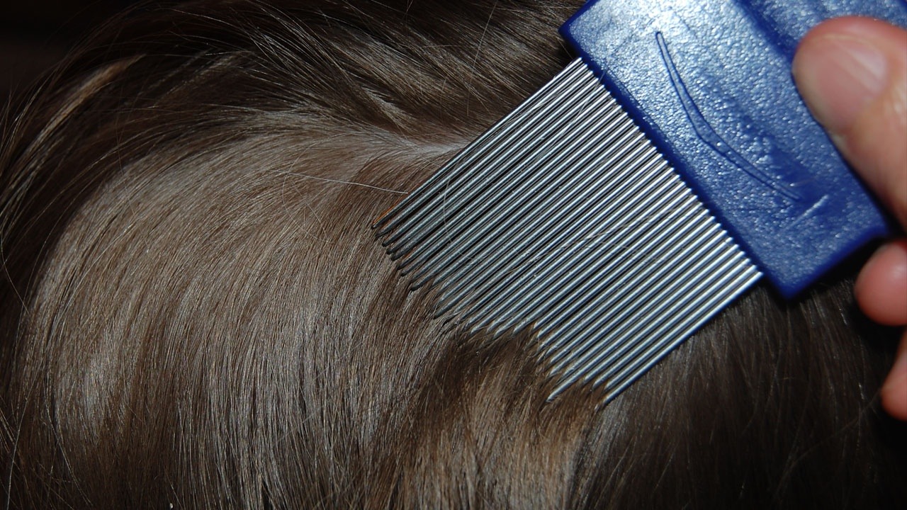 Easy And Safe Way To Take Care Of Head Lice. Put Mayonnaise On Child's