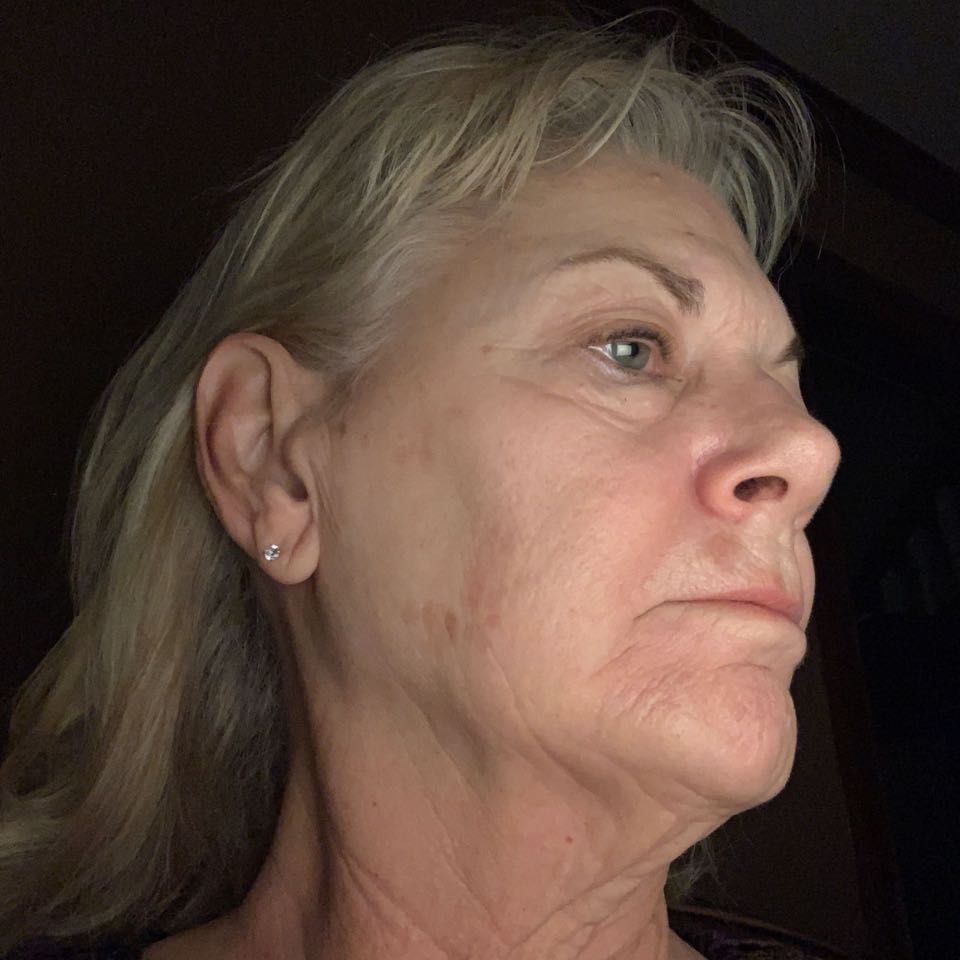 The Spot Cream review photo by andrea R.