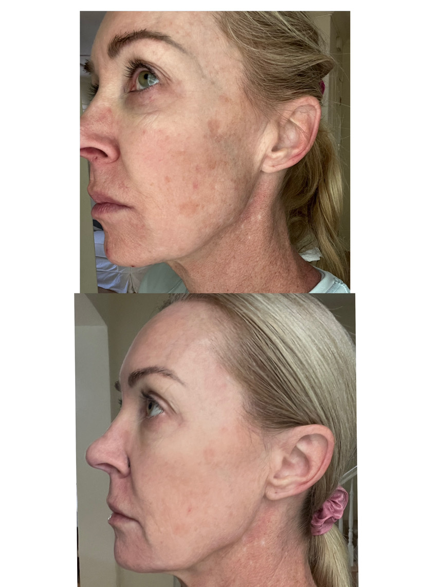 The Spot Cream review photo by Lucy F.