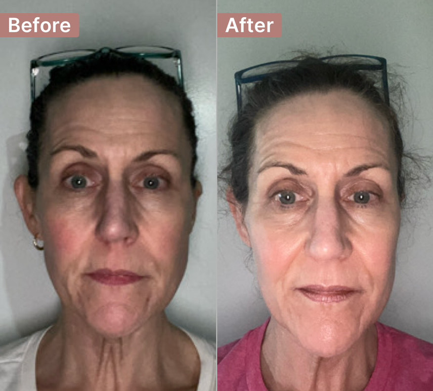 The Aging Repair Cream review photo by Holly S.