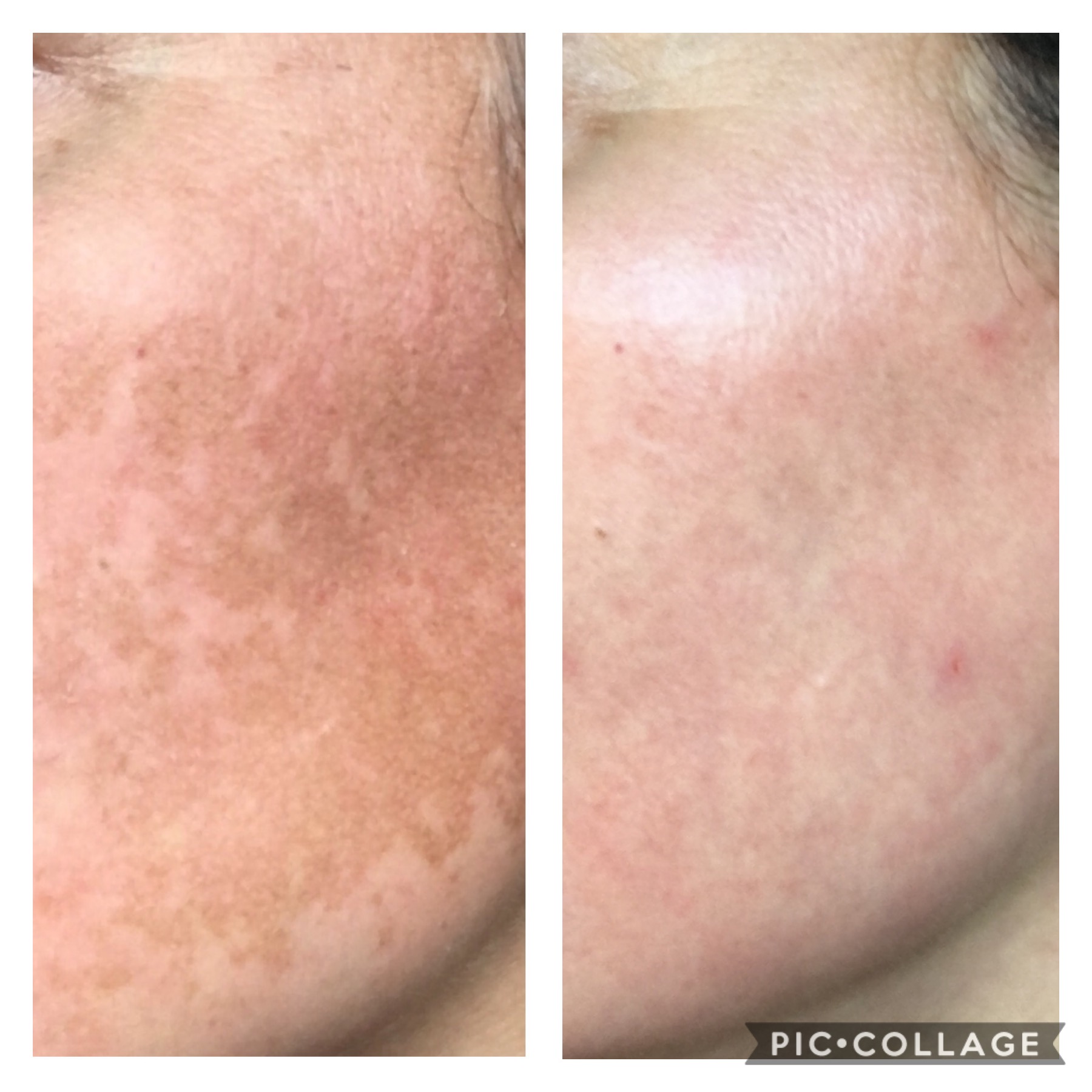 The Spot Cream review photo by Jennifer M.