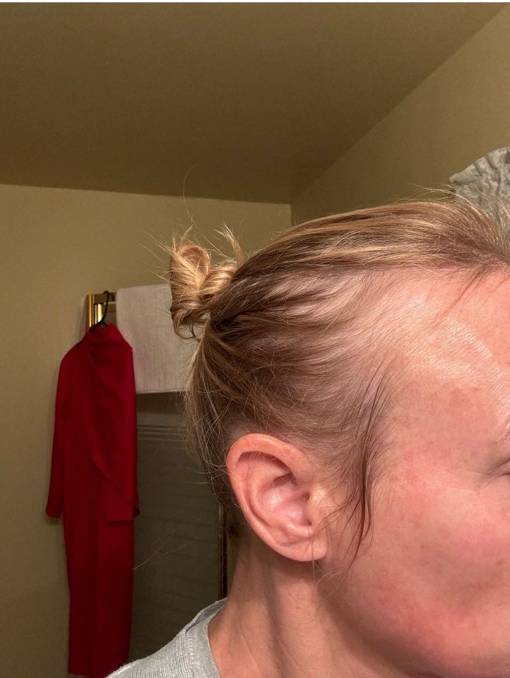 The Hair Topical Solution - Modern review photo by Stacy H.