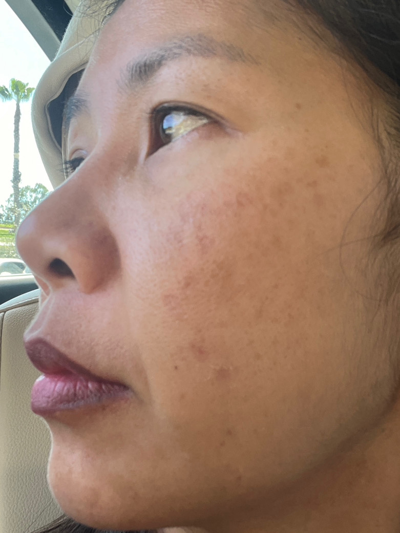 The Spot Cream review photo by Natthacha  B.
