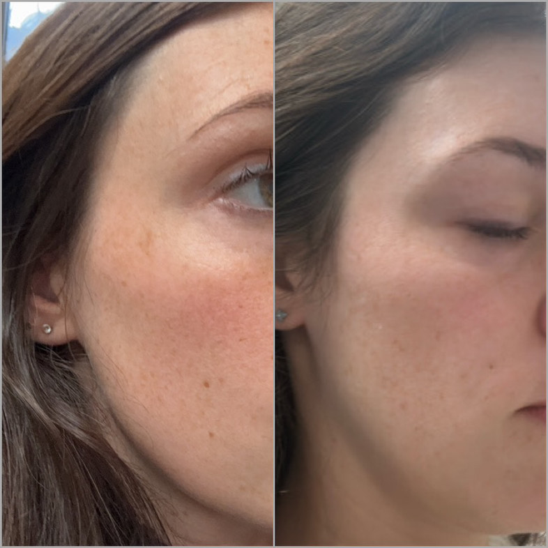 The Spot Cream review photo by Jana W.