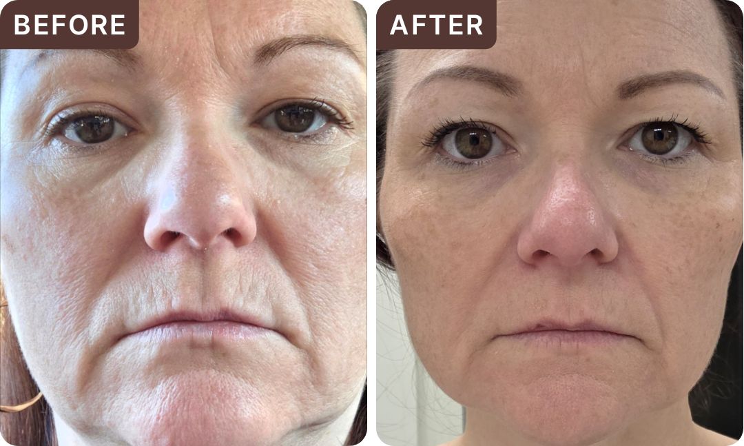 Jessica J. -- before and after, 8 weeks