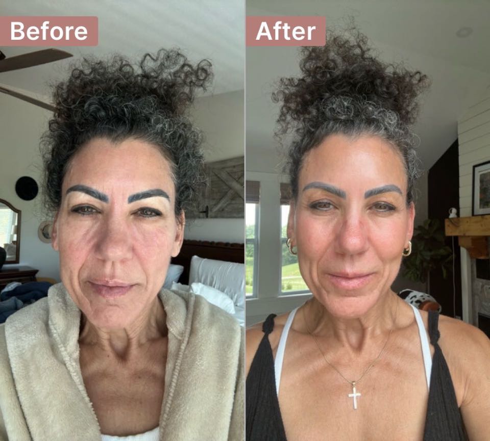 Customer photo