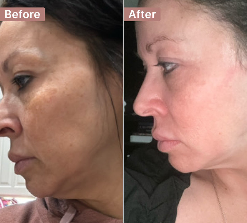 The Spot Cream review photo by veronica V.