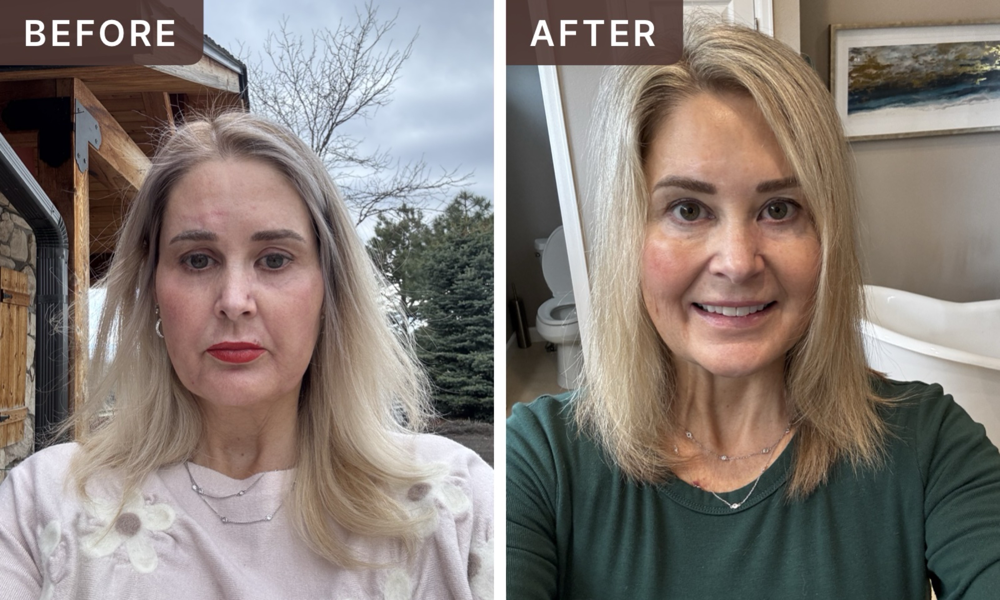 Michelle B. -- before and after, 8 weeks