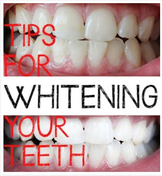 Make Sure You Drink Coffee/Iced Tea/Soda Through A Straw To Prevent