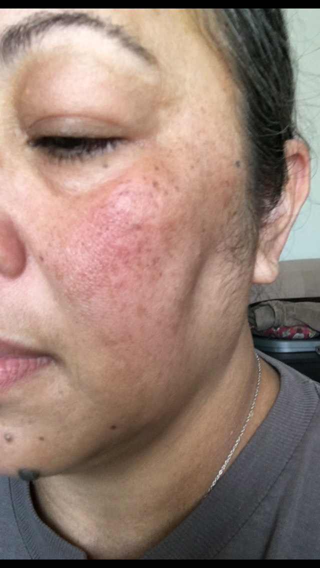 The Spot Cream review photo by Empresson E.