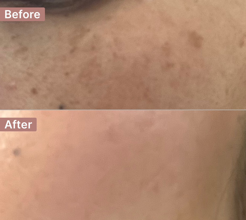 The Spot Cream review photo by Christie  V.