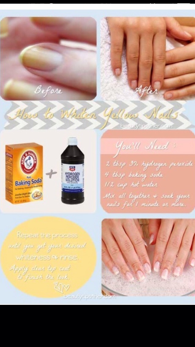 Learn To Whiten Yellow Nails Musely