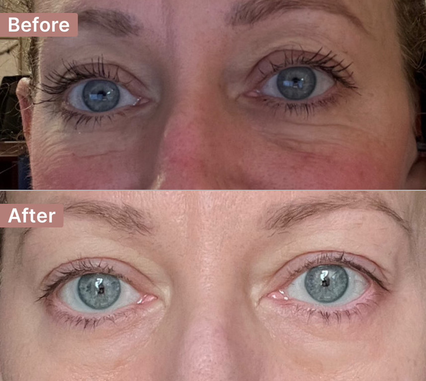 The Eye Serum review photo by Holly E.