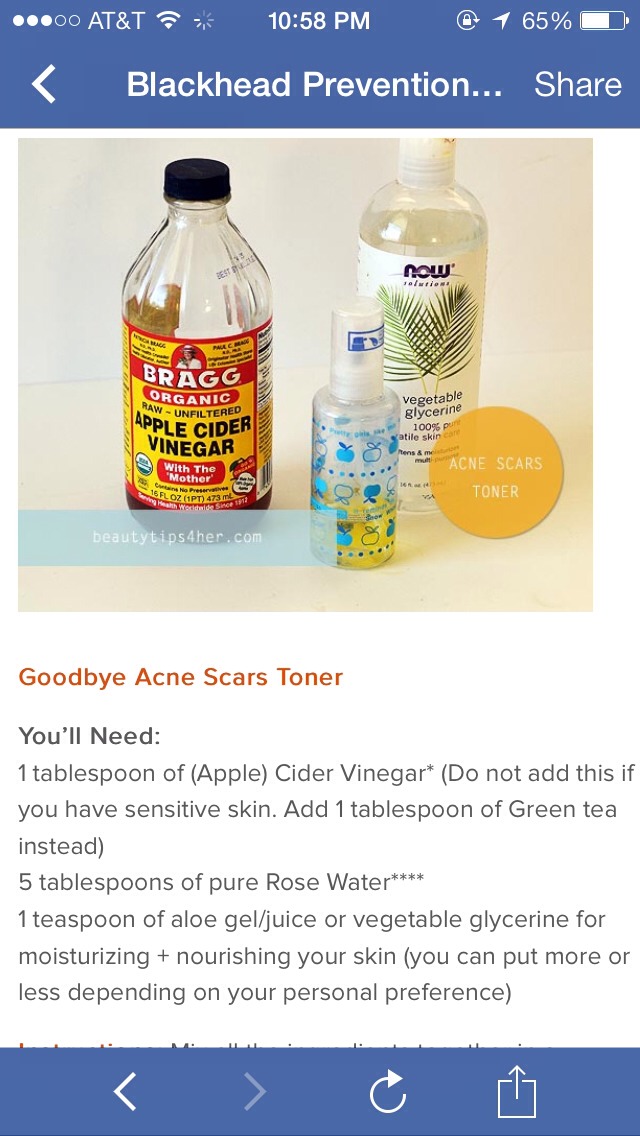 Diy Blackhead Prevention and Acne Scars Toners😍😍😍 Musely
