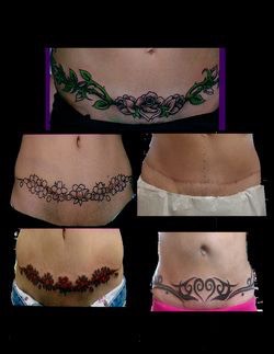 tattoo tattoos tummy tuck scar stretch marks scars tribal section stomach covering hide belly tips please ups hip mark tatoos tattoo tattoos tummy tuck scar stretch marks scars tribal section stomach covering hide belly tips please ups hip mark tatoos