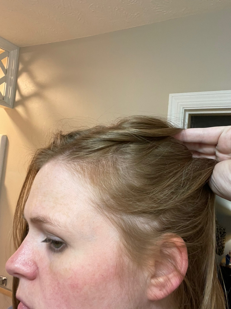 The Hair Topical Solution - Modern review photo by Carolyn  E.