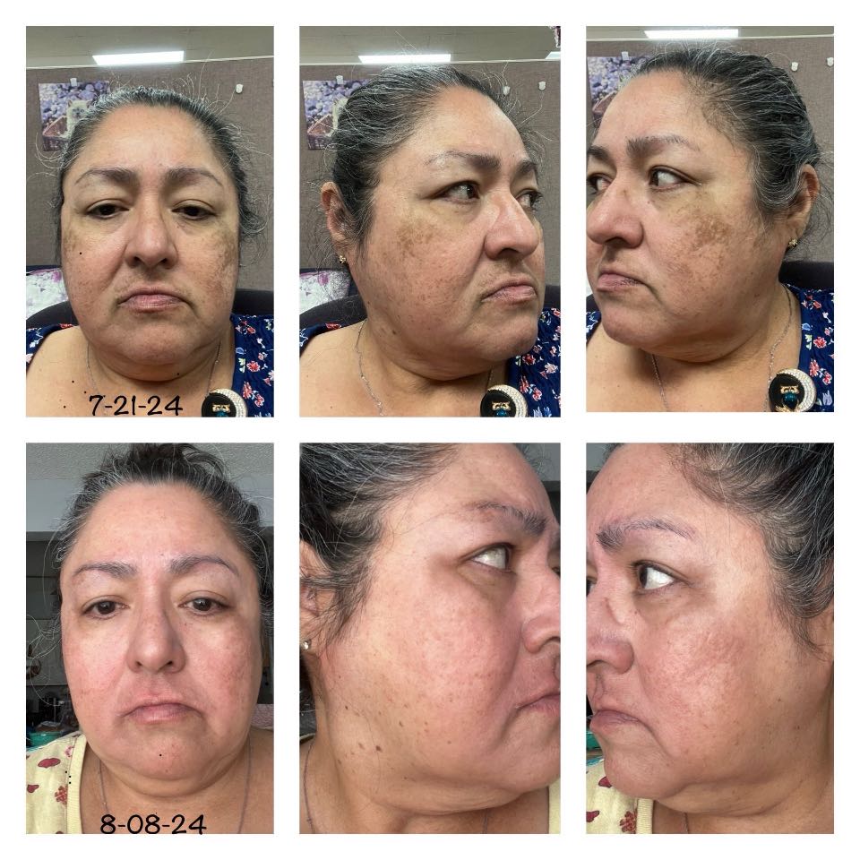 Customer photo