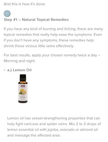 Naturally Get Rid Of Spider Veins Fast Naturally Get Rid Of Spider Veins Fast