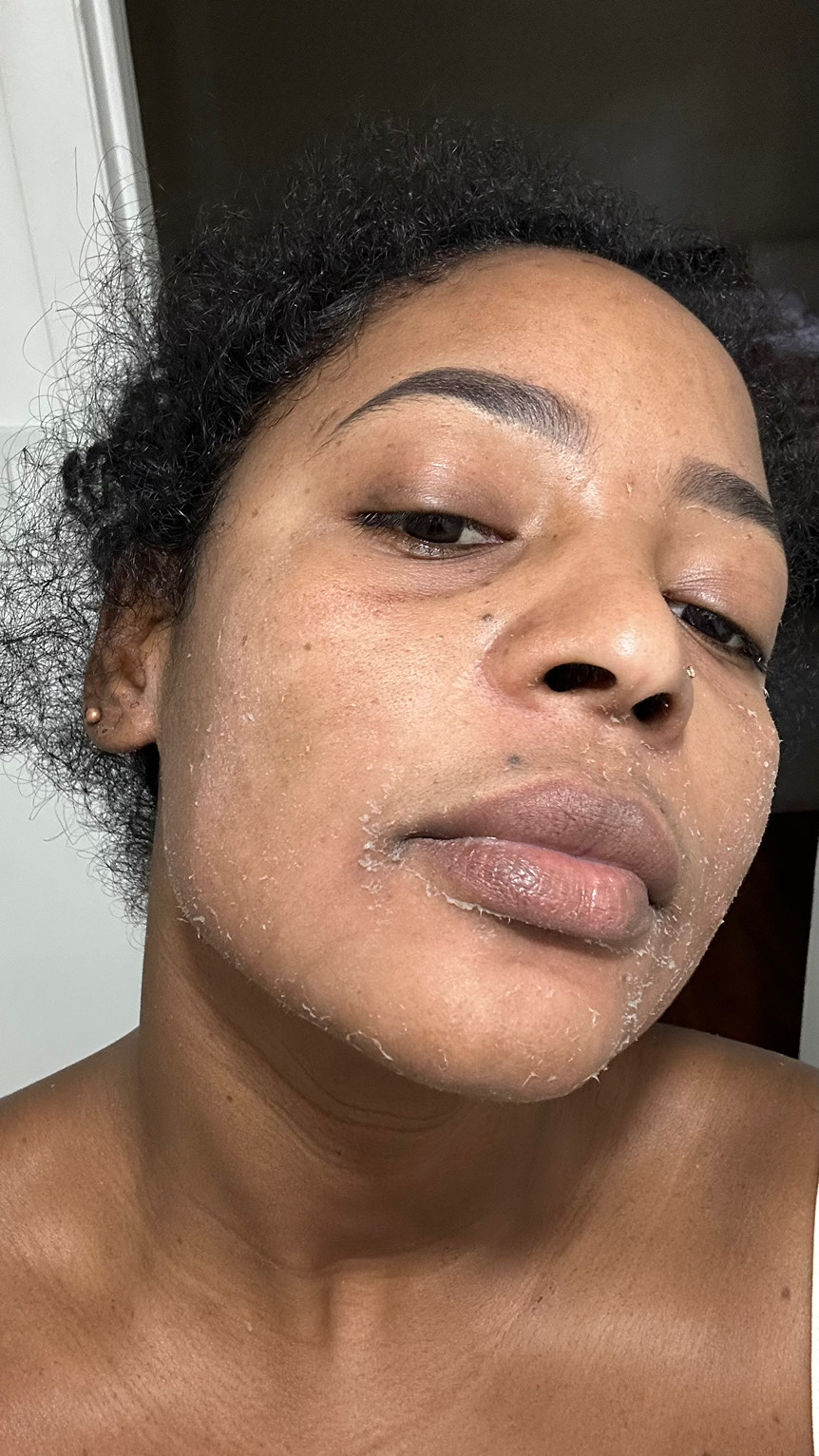 The Eye Serum review photo by ANABEL G.