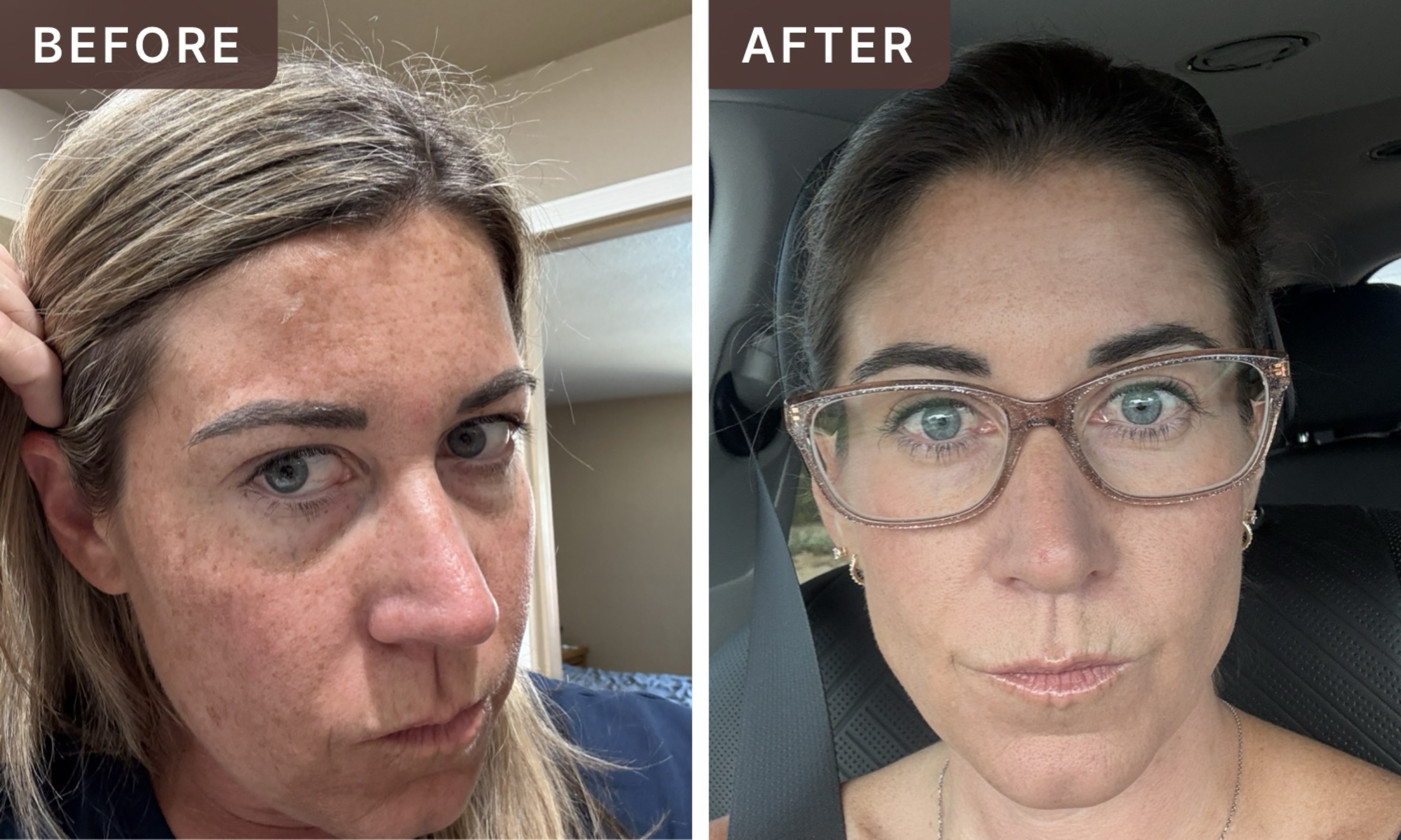 Holly P. -- before and after, 8 weeks
