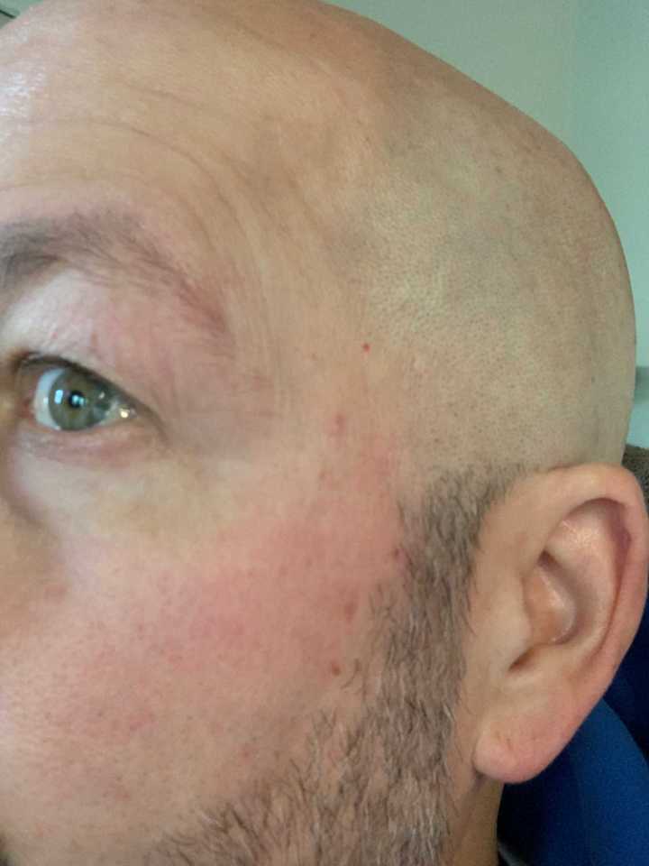 The Spot Cream review photo by Craig L.