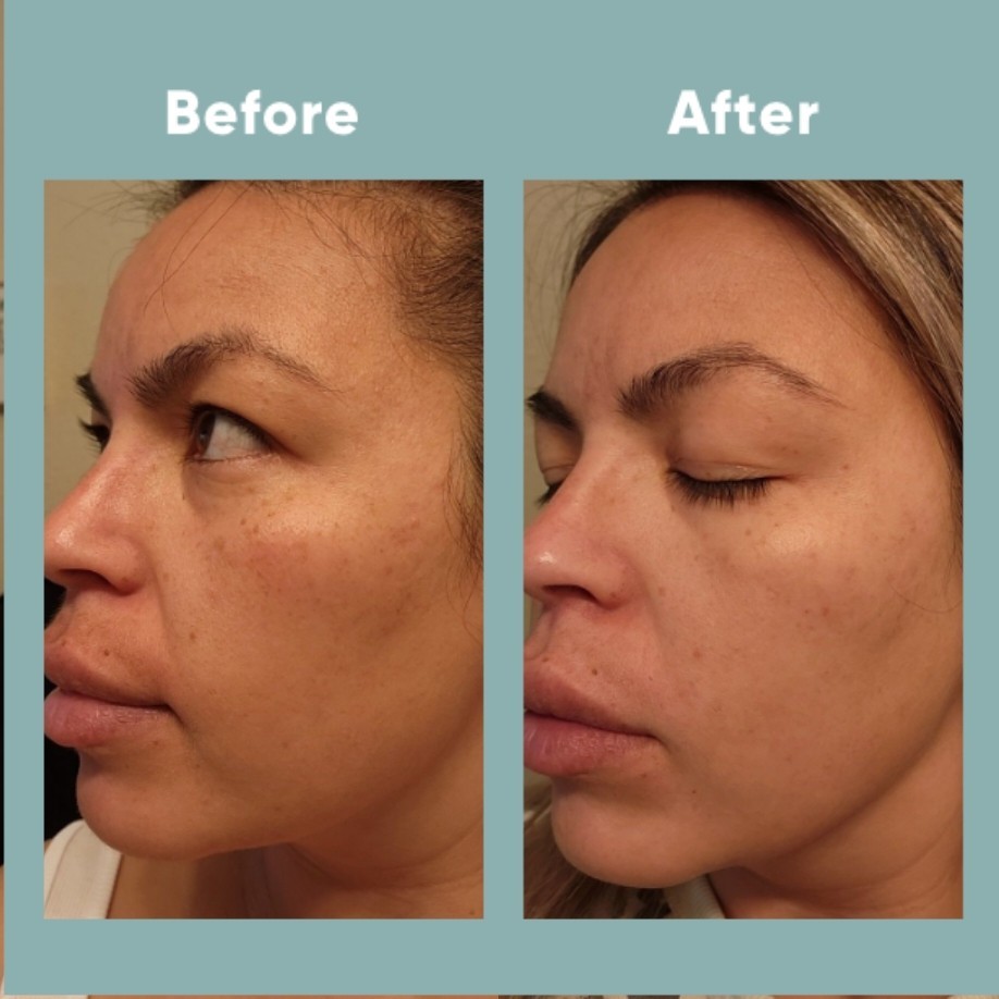 The Spot Cream review photo by Lourdes C.