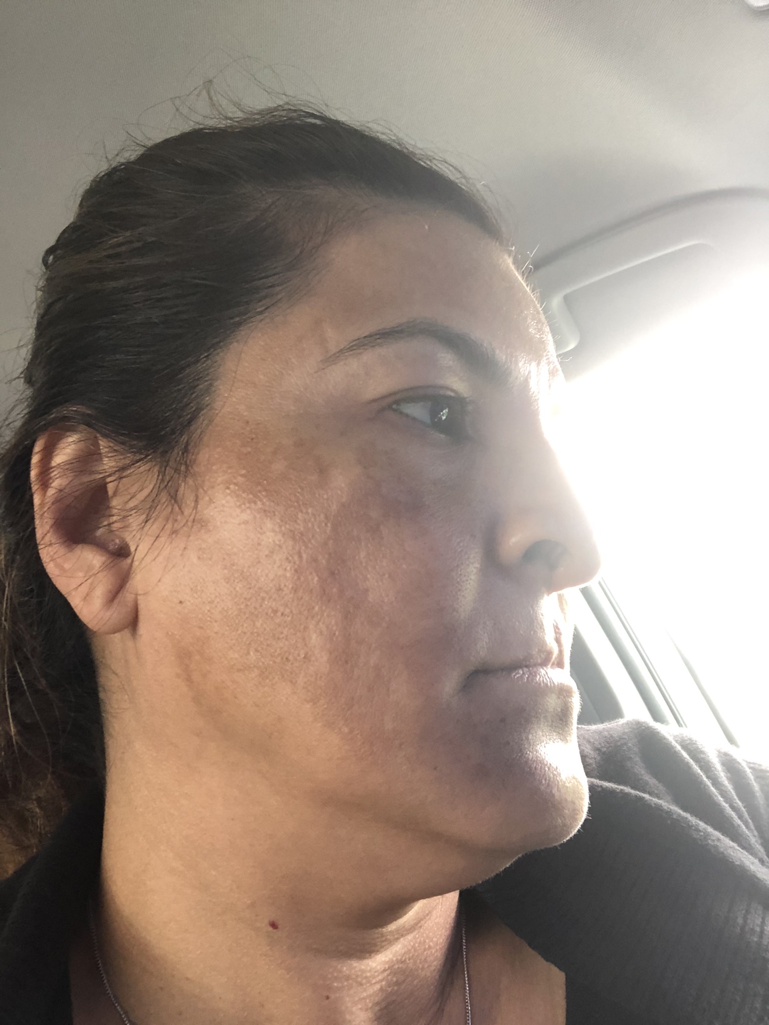The Spot Cream review photo by Lisa H.