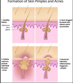 Natural Treatments For Sleep Deprivation Natural Treatments For Sleep Deprivation