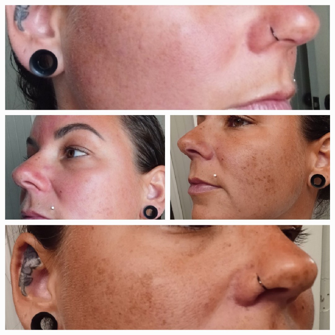 The Spot Cream review photo by Nichole K.