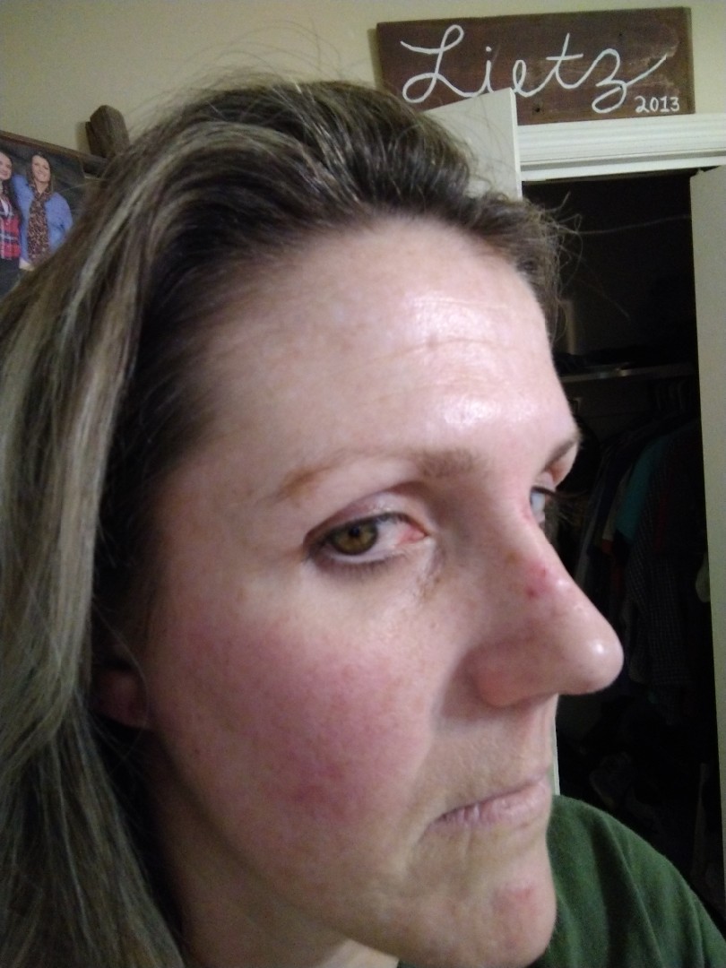 The Spot Cream review photo by Trish L.