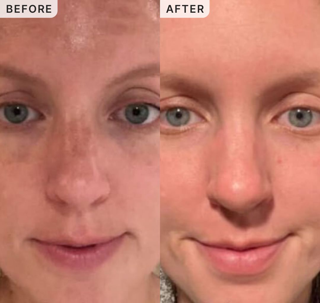 Jt02 Y. -- before and after, 8 weeks