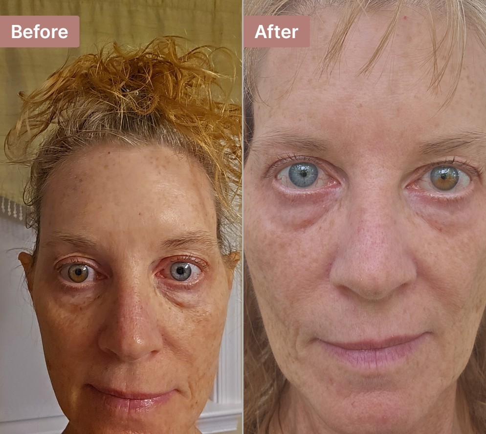 The Eye Serum review photo by Leslie A.