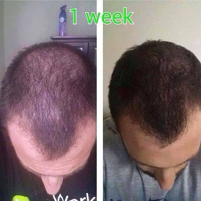 Longer Healthier Hair In One Week By Christal Shoemake Musely