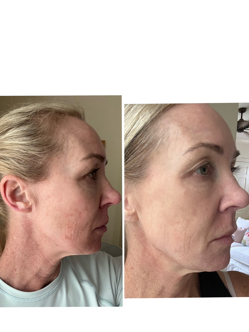 The Spot Cream review photo by Lucy F.