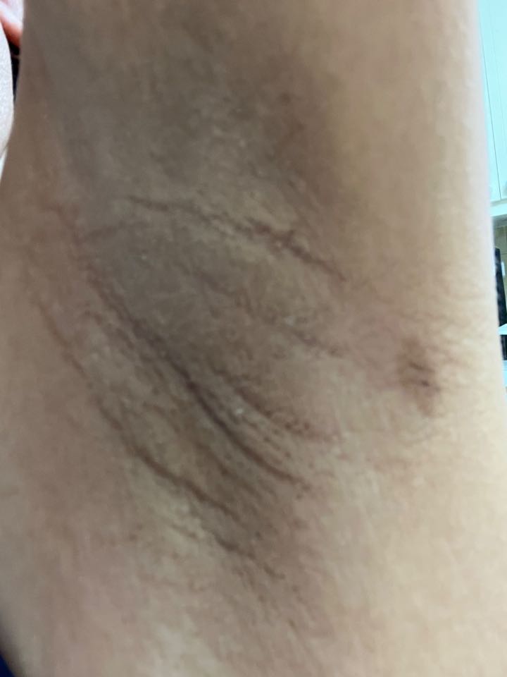 Customer photo