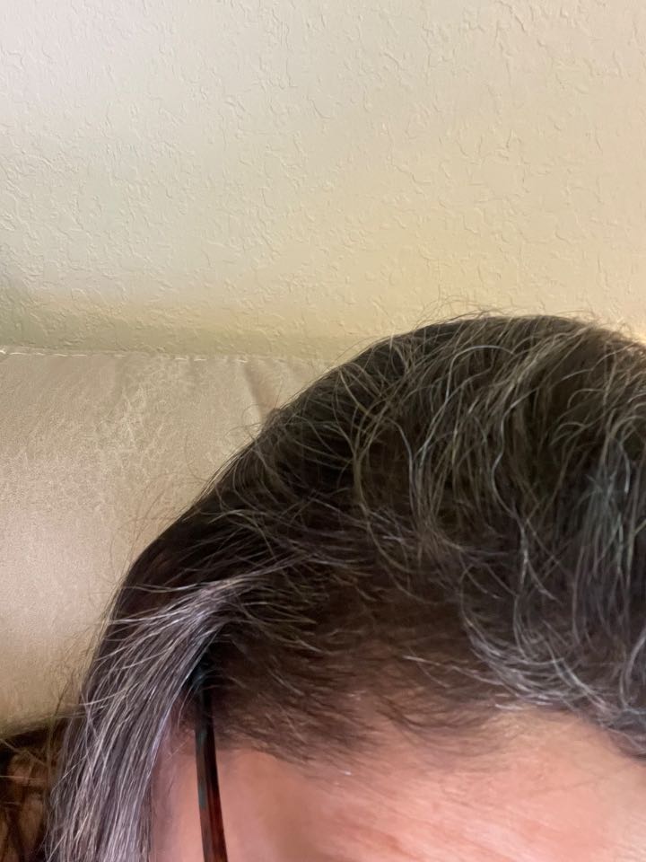 The Hair Pill review photo by Gladys S.