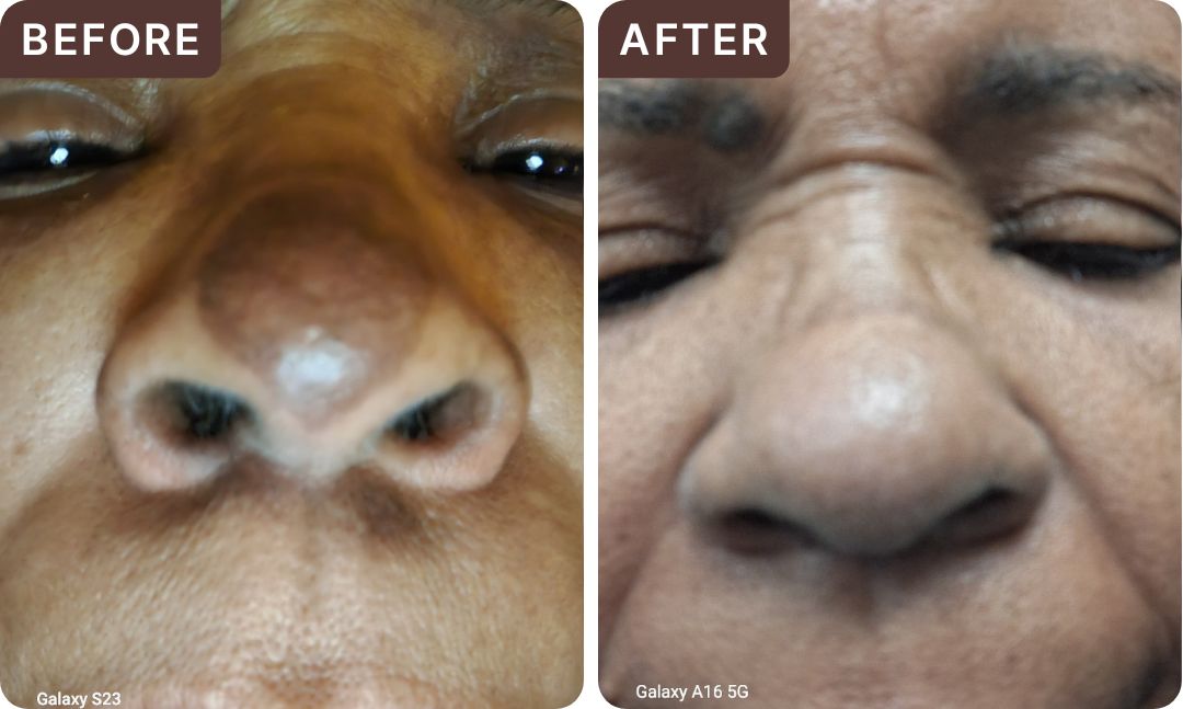 Janie N. -- before and after, 8 weeks