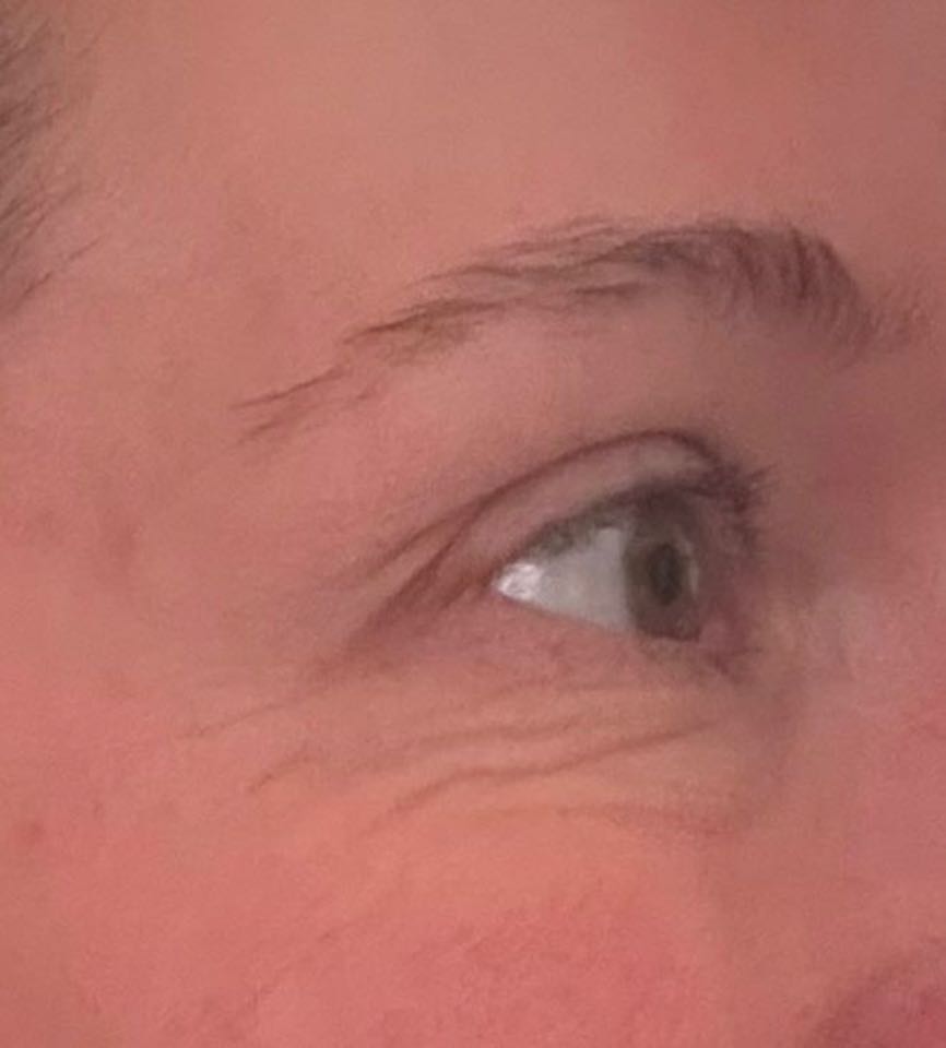 The Eye Serum review photo by Lauren A.