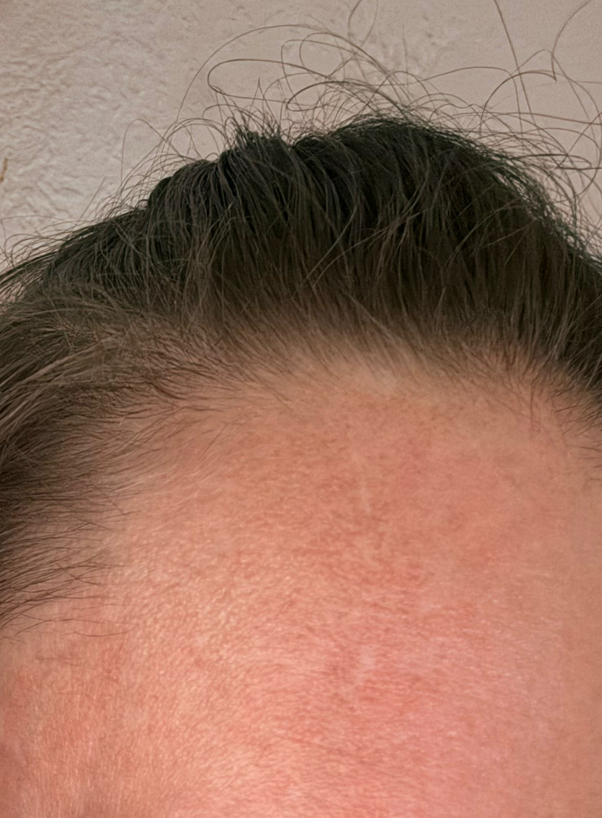 The Spot Cream review photo by Shannon  M.