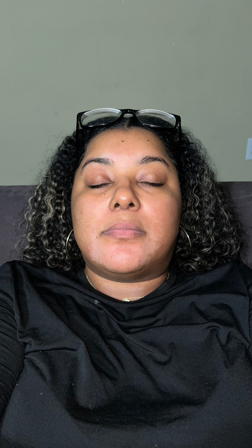 The Spot Peel review photo by Yauna F.