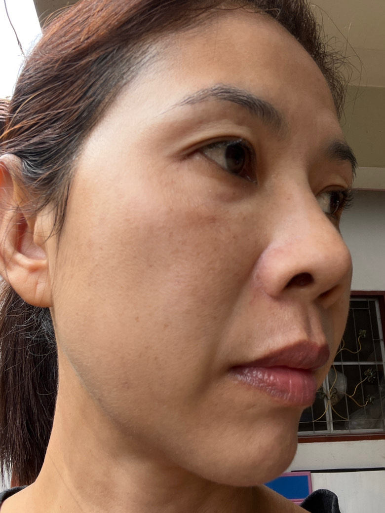 The Spot Cream review photo by Natthacha  B.