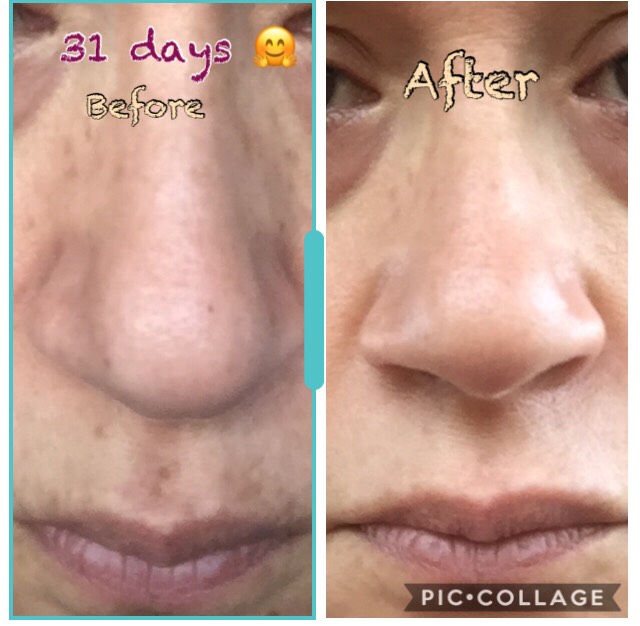 The Spot Cream review photo by Mercedes C.