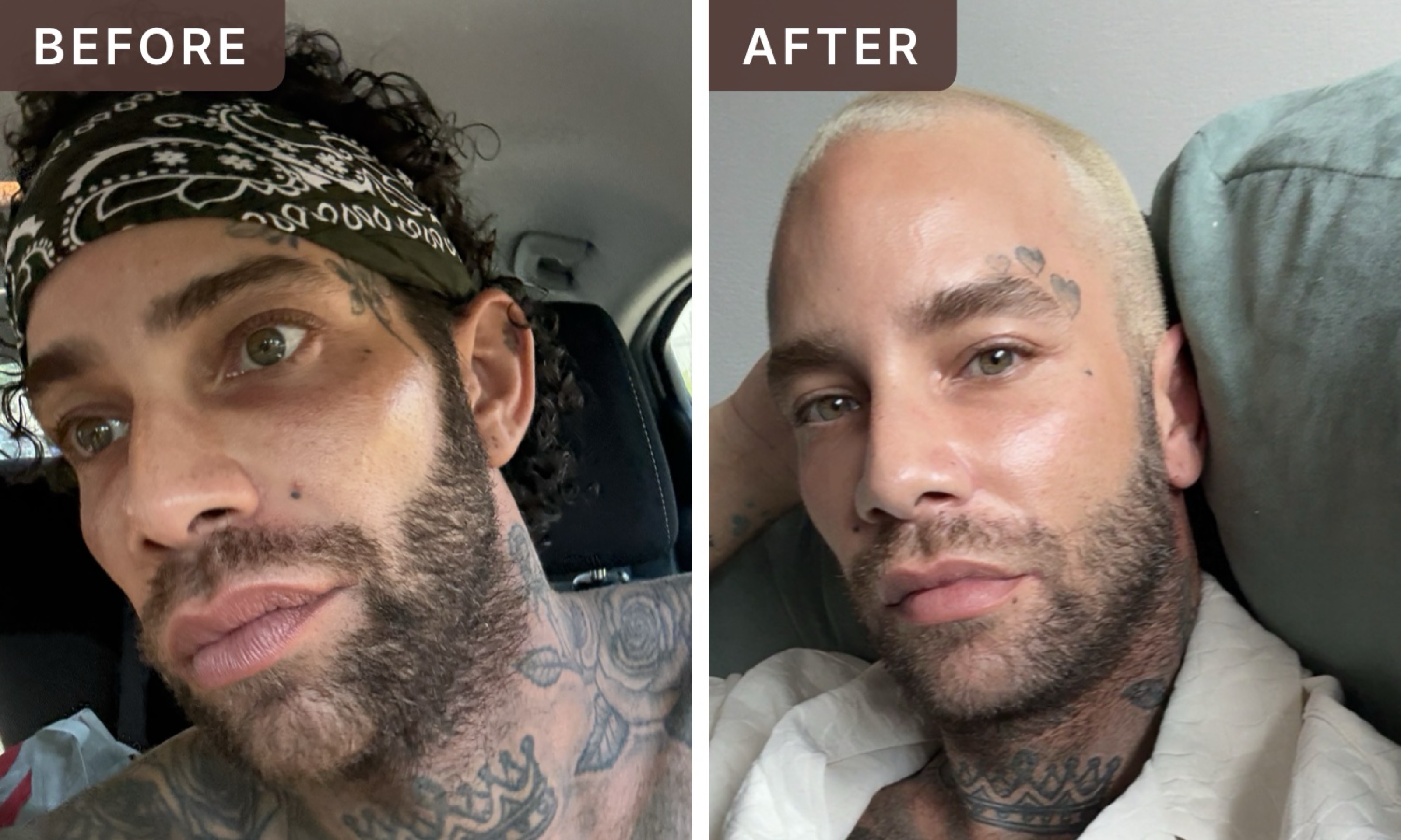 Mike D. -- before and after, 8 weeks