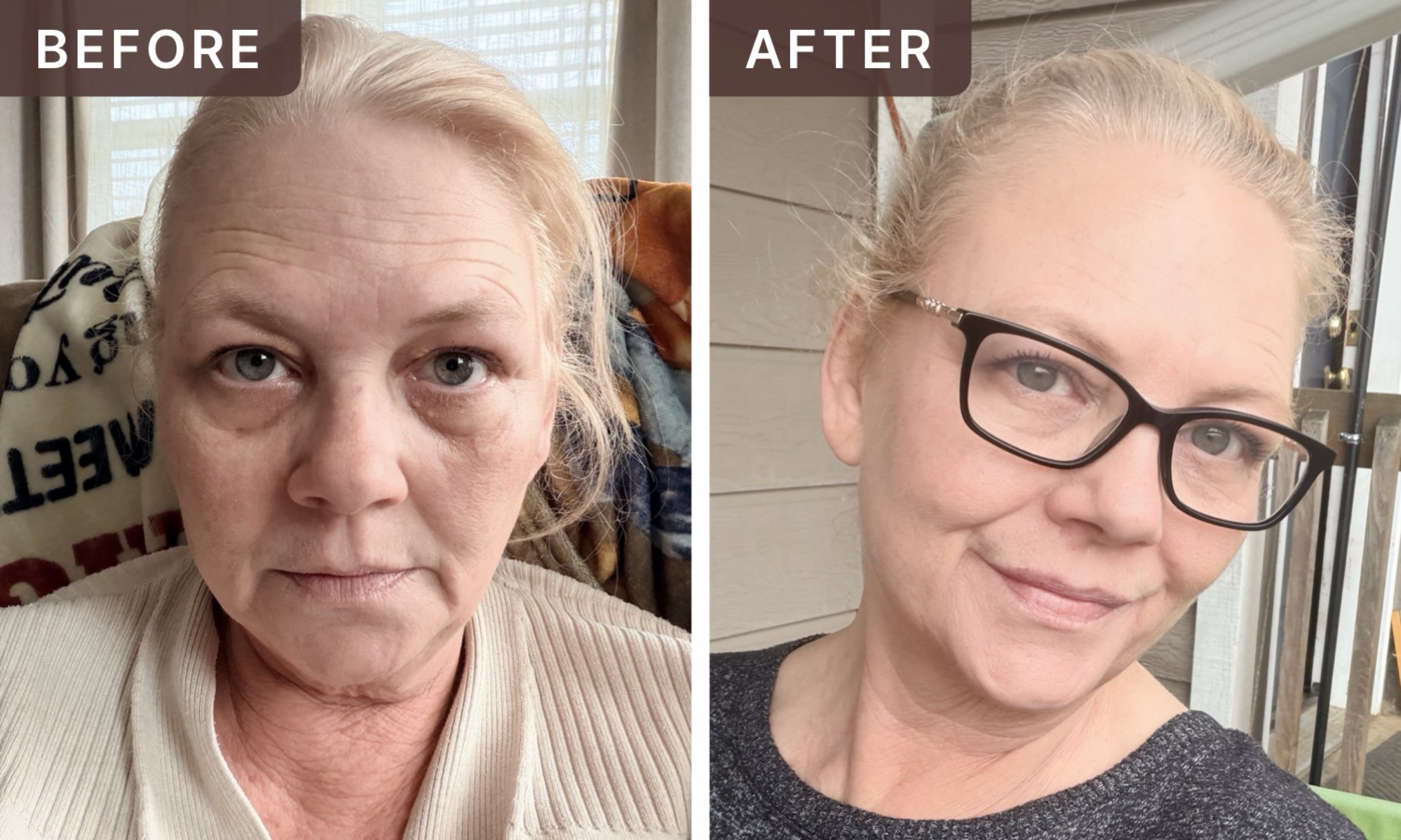 Michelle S. -- before and after, 8 weeks